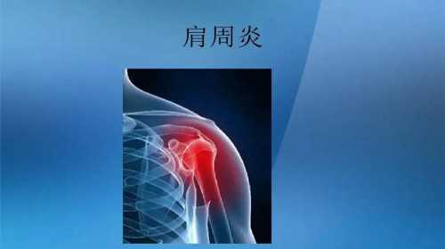 重庆海扶刀治疗子宫腺肌症,12月28日，重庆这段时间很多学生都在家里上网课，